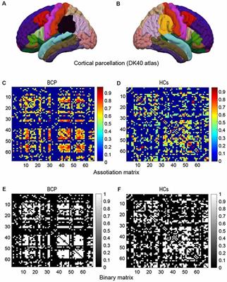 Abnormal Gray Matter Structural Covariance Networks in Children With Bilateral Cerebral Palsy